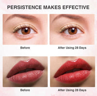 ElyftCo™ UnderEye Tightening Pen